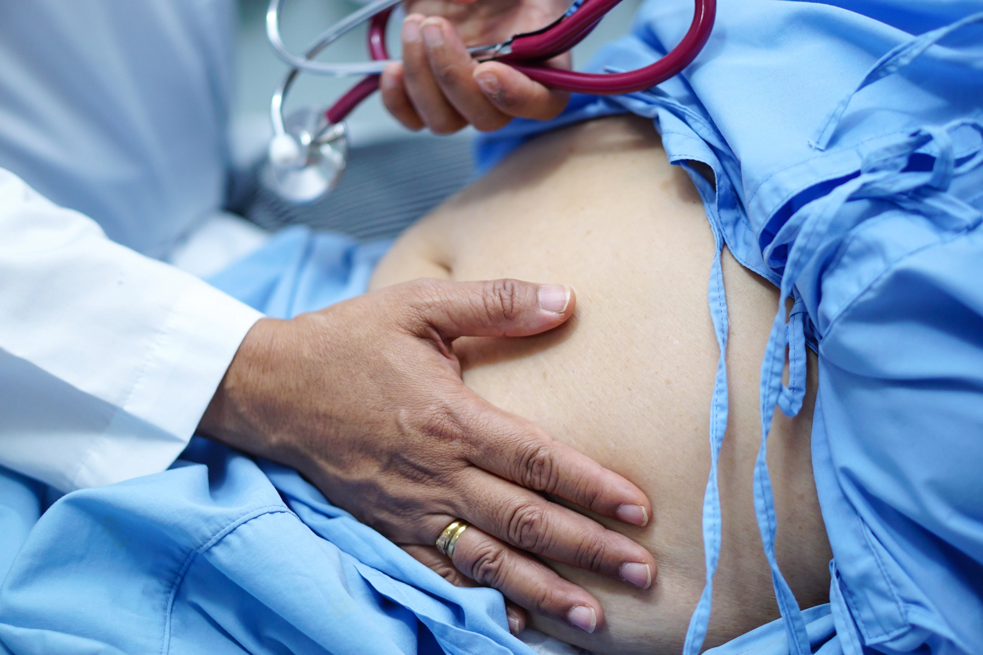 Hernias