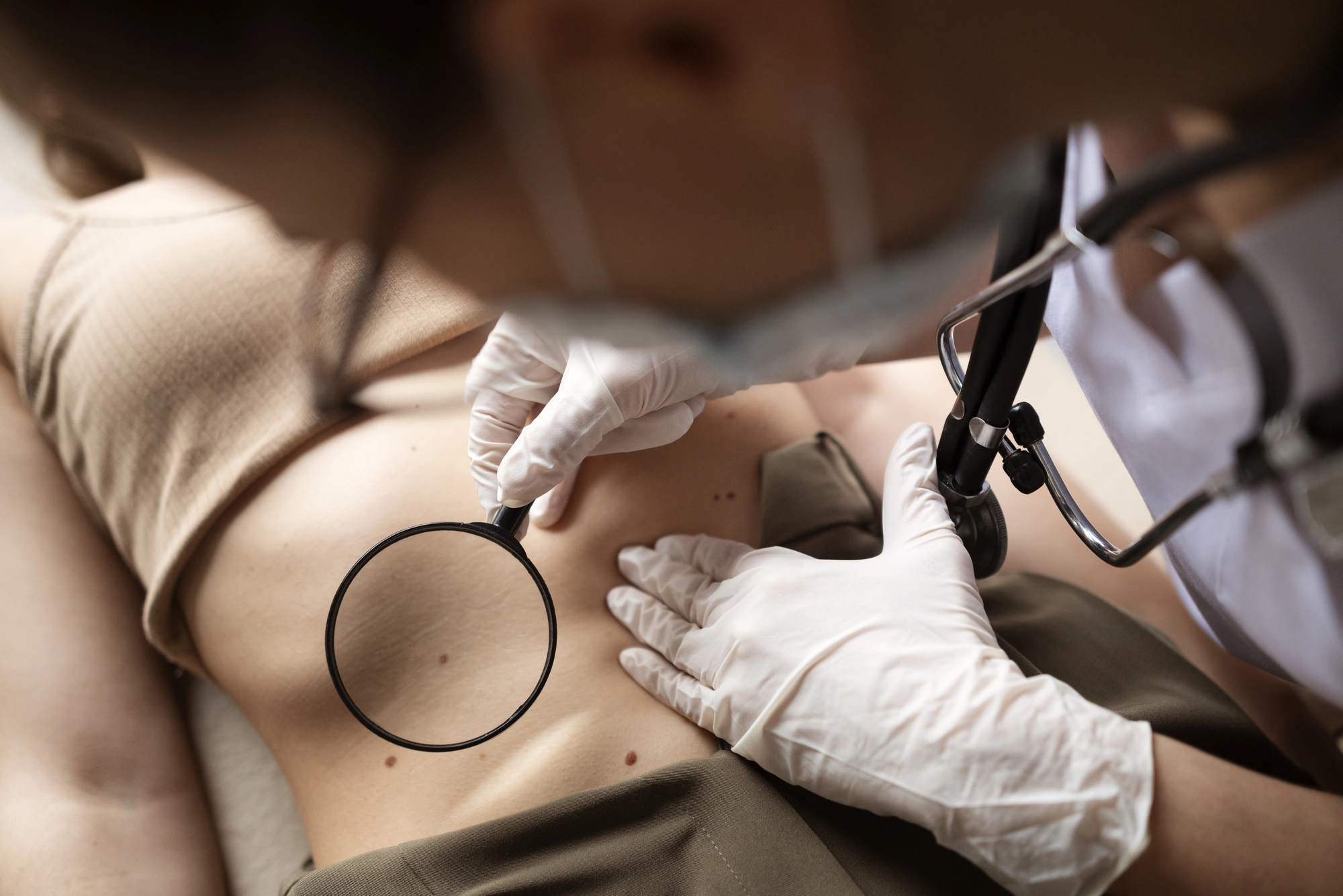 Diagnóstico de lipoma