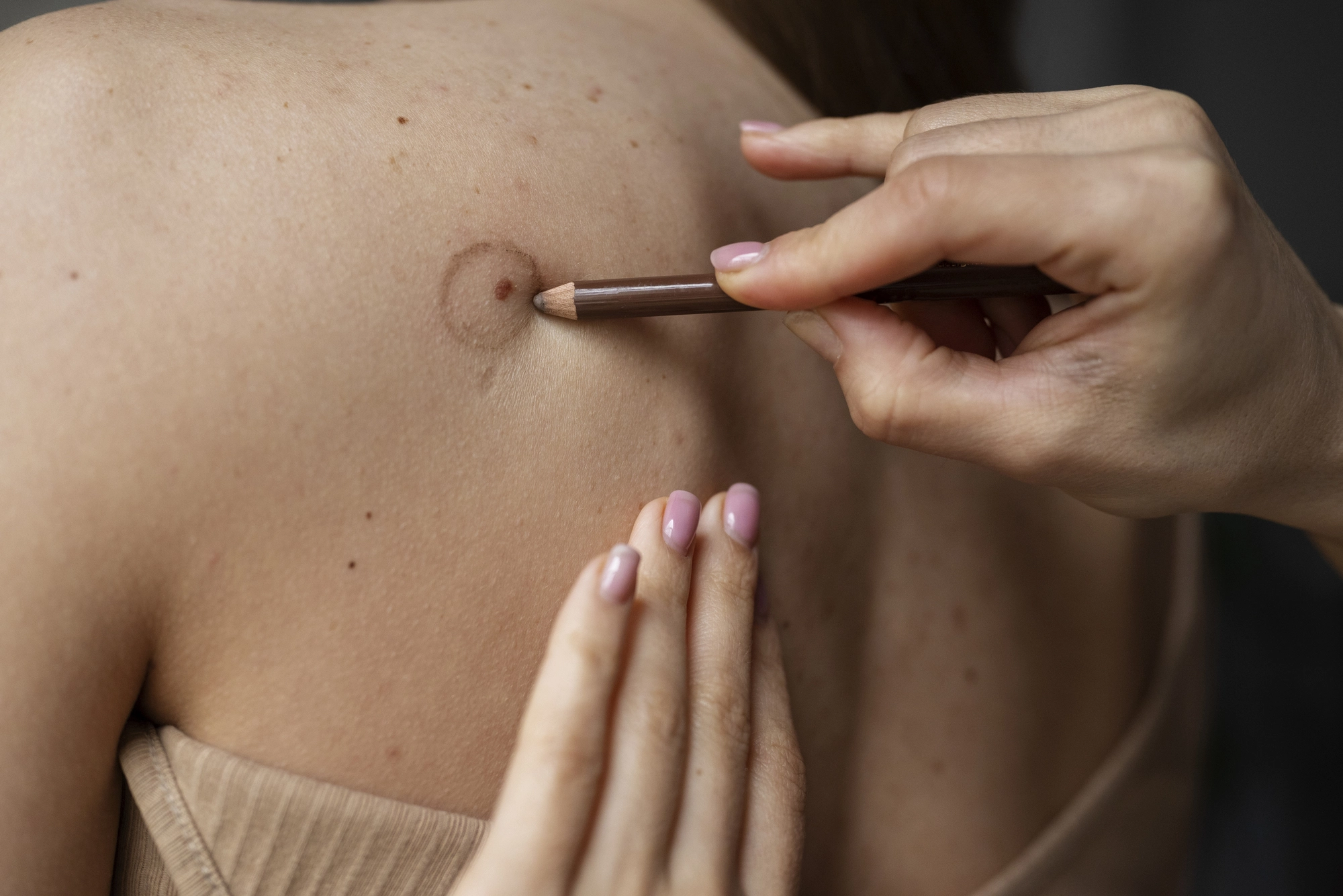 Efectividad en procedimientos dermatológicos