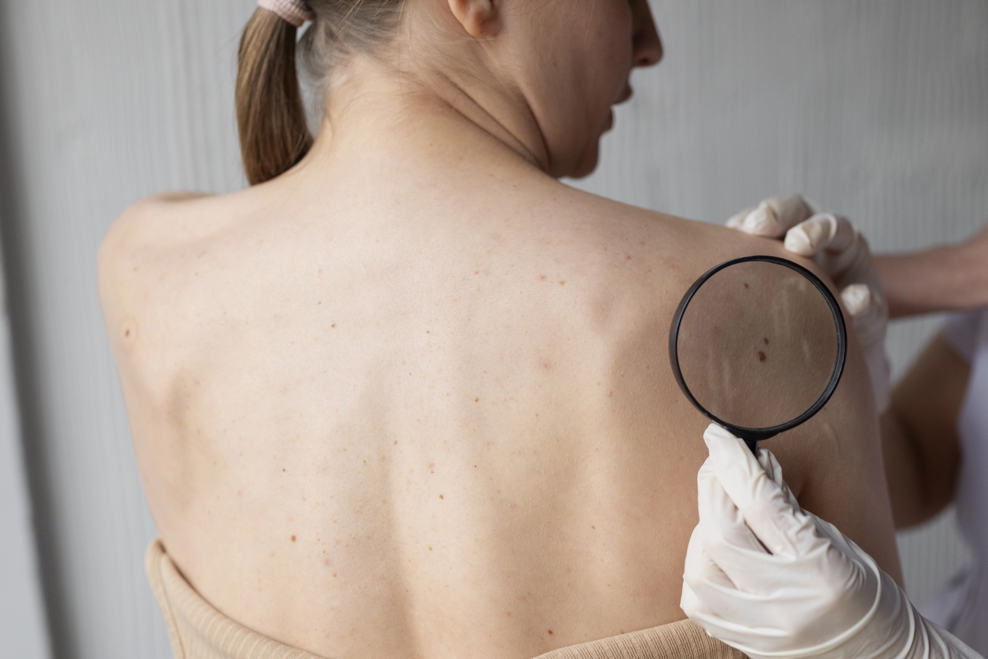 Diagnóstico dermatológico previo al curetaje