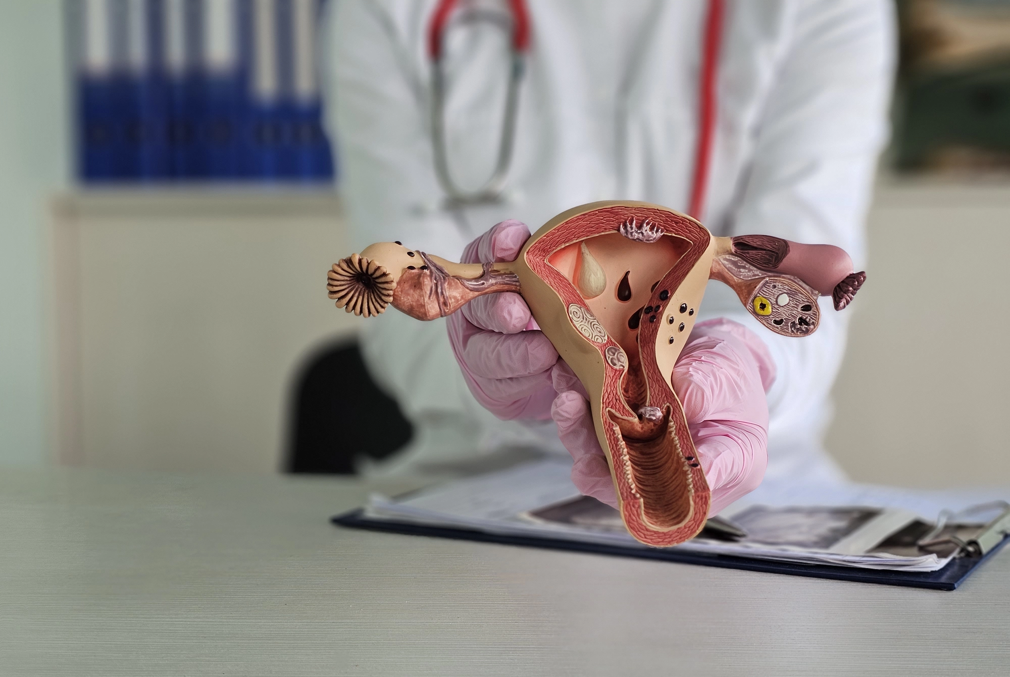 Consulta ginecológica y diagnóstico cervical