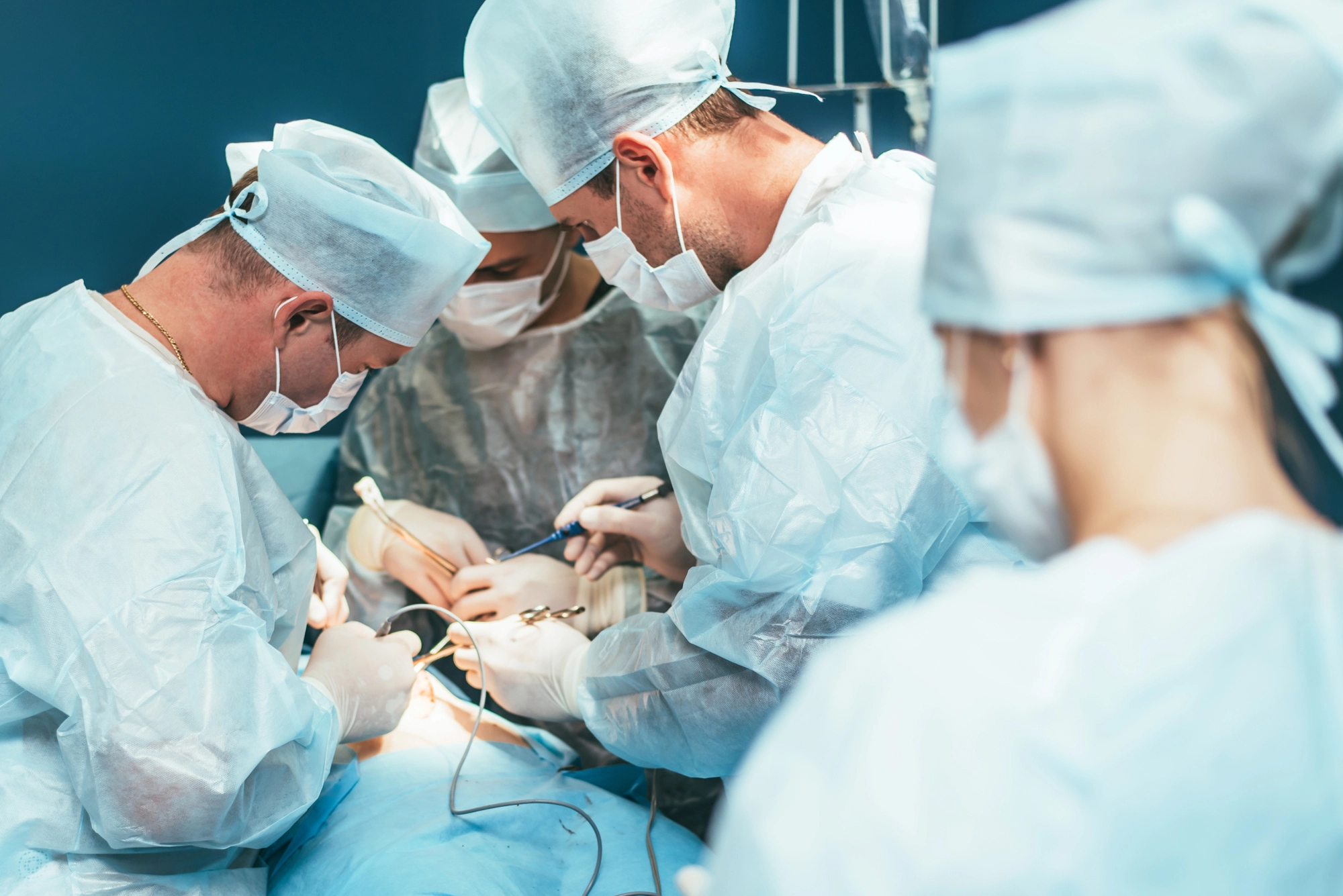 Equipo médico en cirugía ginecológica