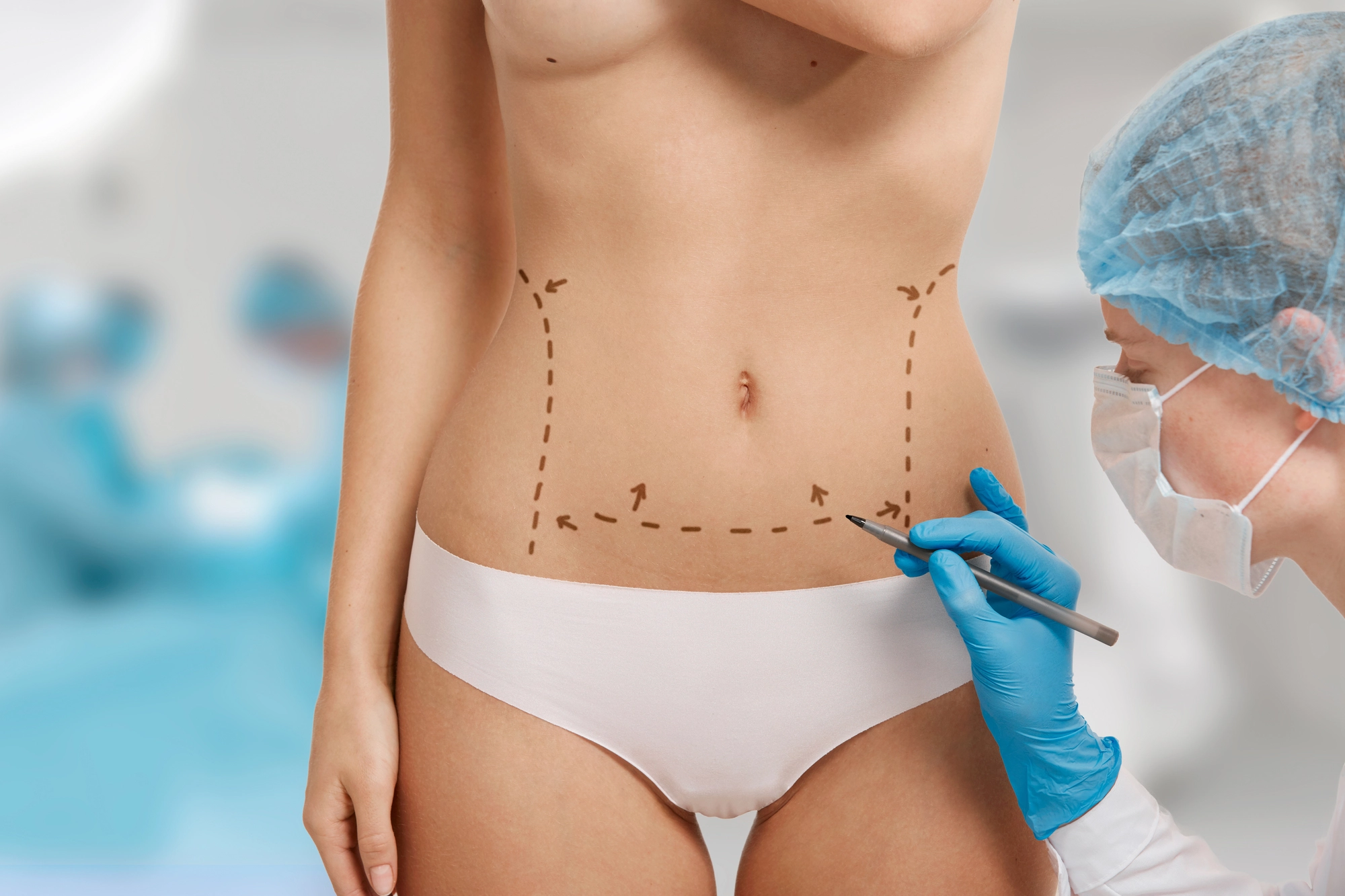 Eventración Abdominal